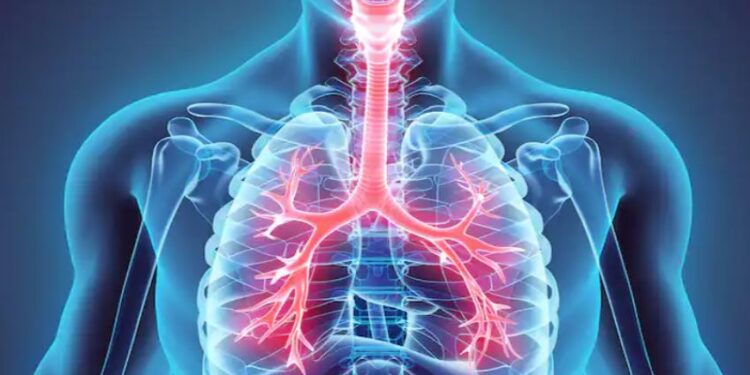 ಶ್ವಾಸಕೋಶದ ಗ್ರಾಫಿಕ್ ಚಿತ್ರ
