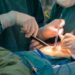 Cesarean surgery